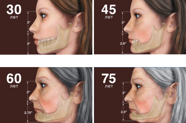Пример костной патологии на лице